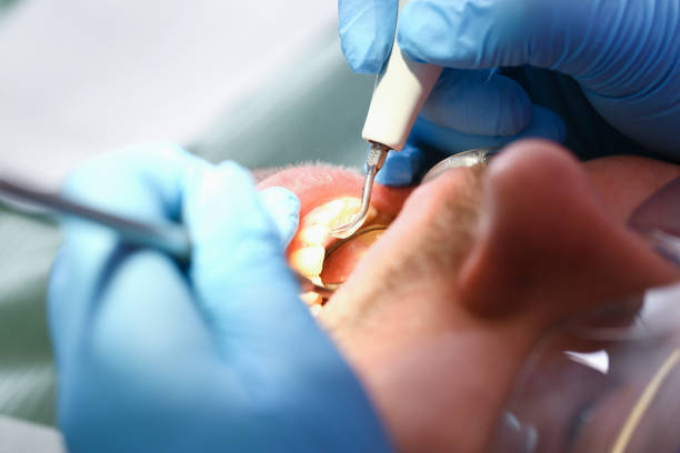 Best Cosmetic Emergency Dentistry in Benjamin, UT