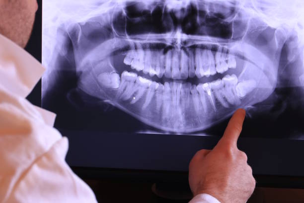 Best Emergency Dental Care for Broken or Chipped Teeth in Benjamin, UT