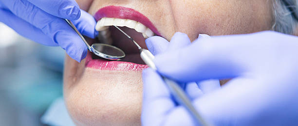 Best Urgent Care for Lost Fillings or Crowns in Benjamin, UT